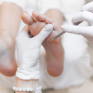 Удаление стержневой мозоли