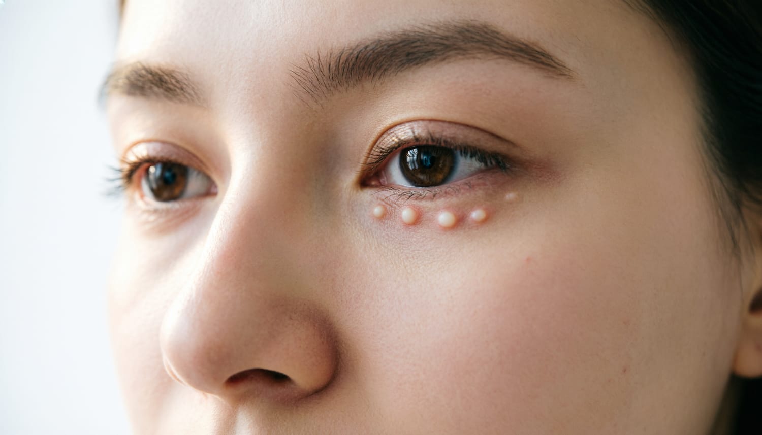 Область вокруг глаз и на веках
