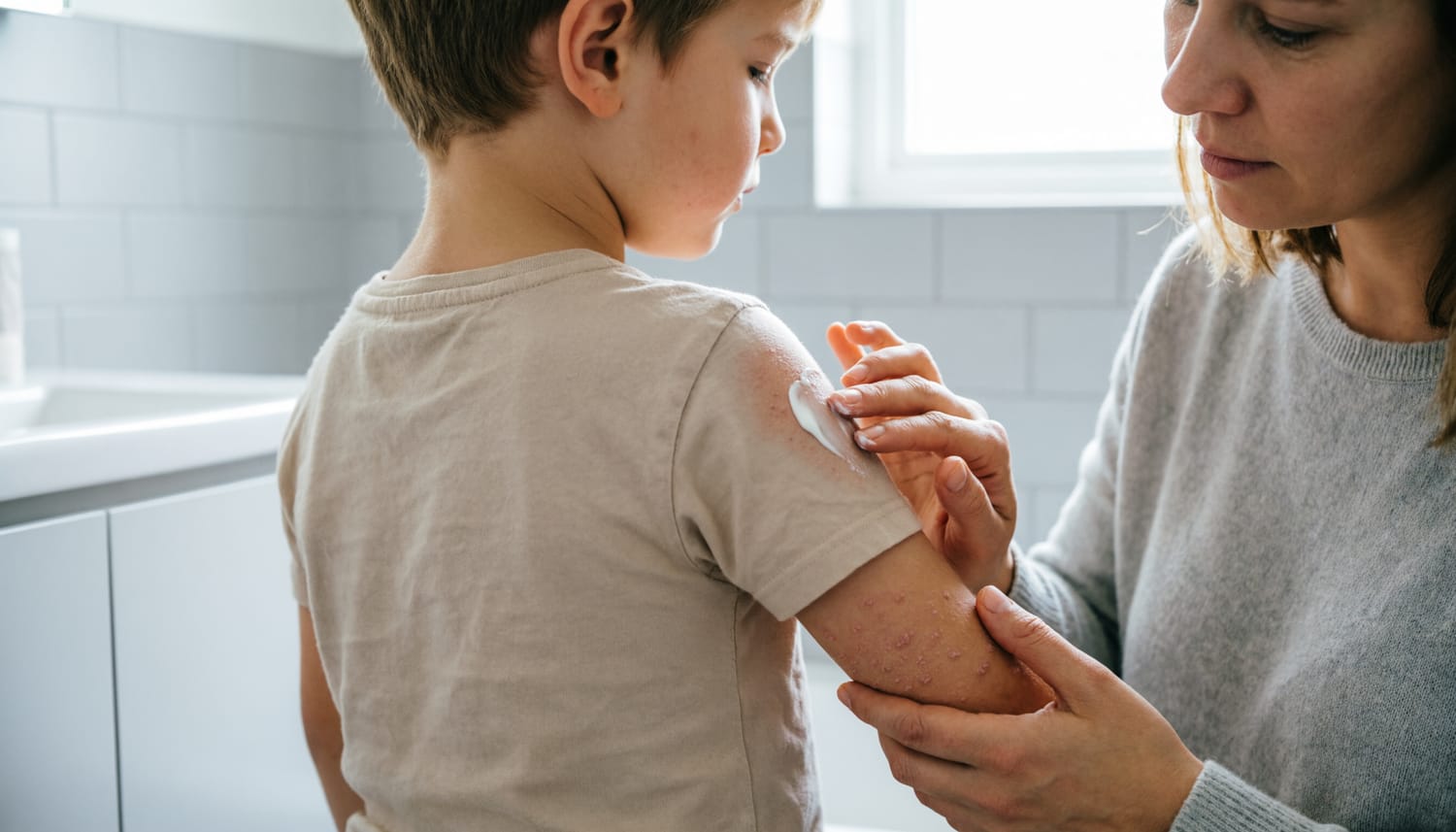 Фолликулярный гиперкератоз («гусиная кожа»)